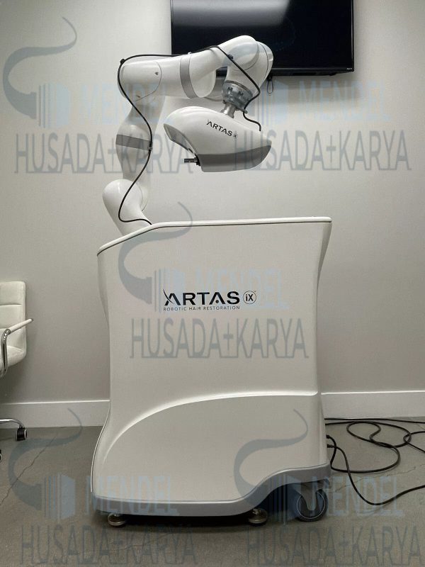 Artas Ix Robotic Hair Transplant System