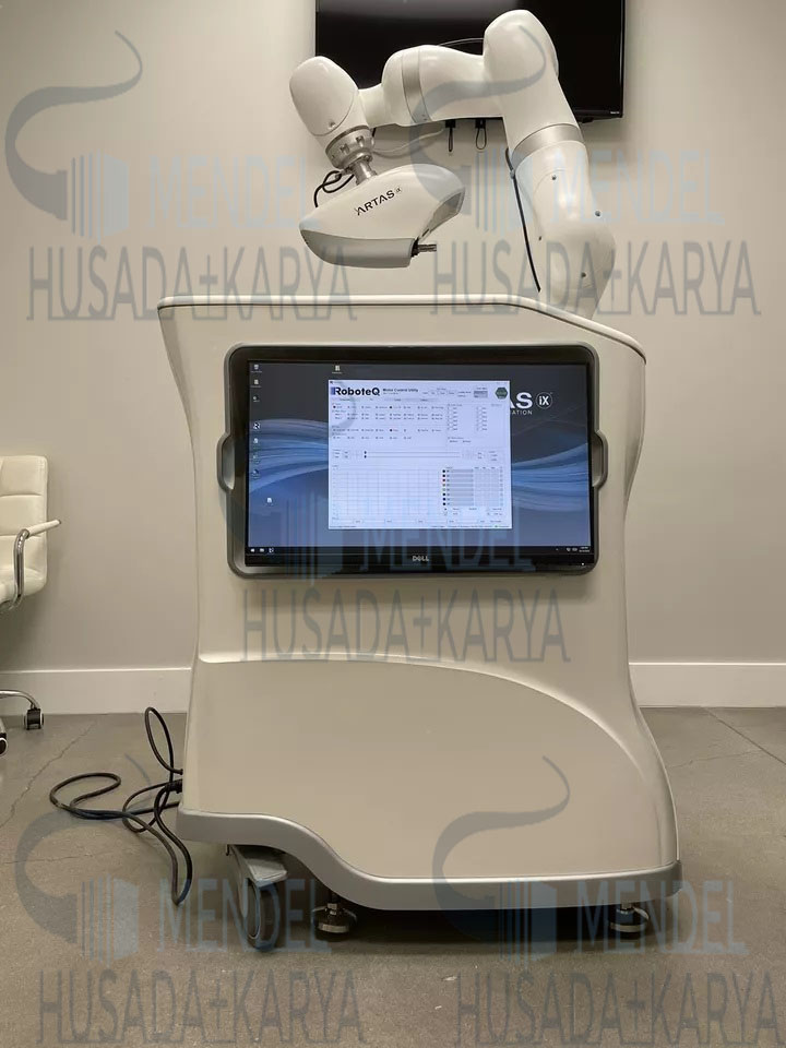 Artas Ix Robotic Hair Transplant System