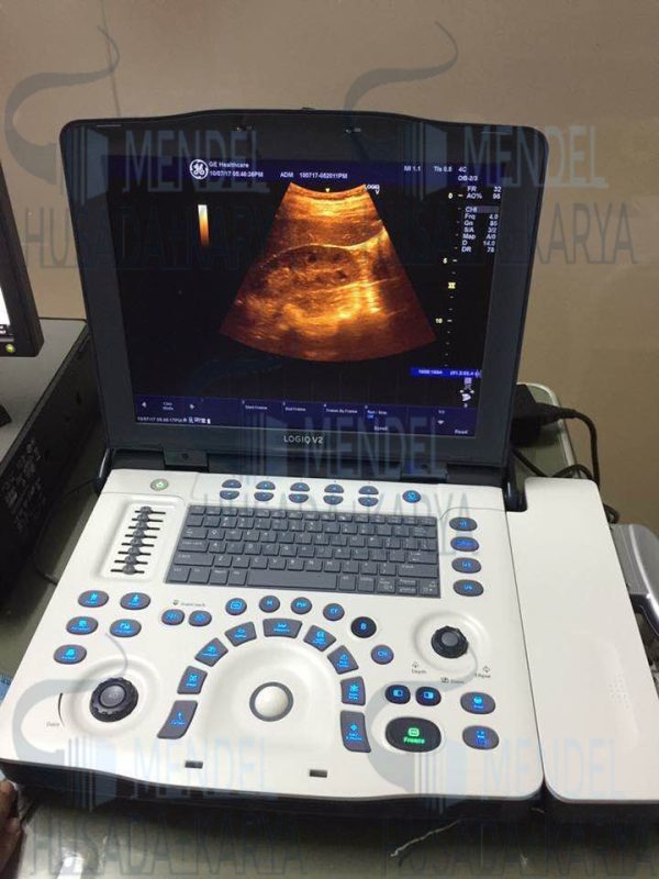 GE Logiq V2 Ultrasound System - Image 2